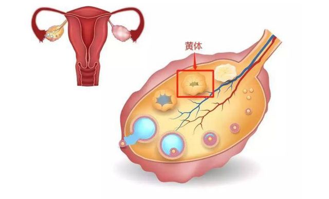 1,卵巢发育和黄体形成缺陷   如果女性的卵巢发育和黄体形成有