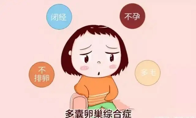 贝安健康：多囊怎么备孕?