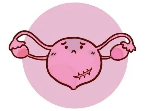 贝安健康：多囊和多囊卵巢综合征的区别