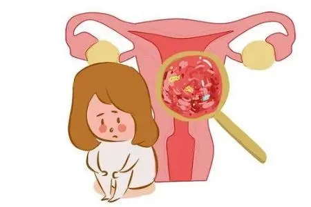 贝安健康：宫颈息肉的症状和危害